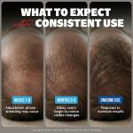 Kirkland Minoxidil 5% Solution | Hair & Beard Growth Treatment for Men | FDA Approved – 3 Botol