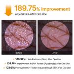Dr.Melaxin PEEL SHOT – Exfoliating Kojic Acid & Turmeric Spray